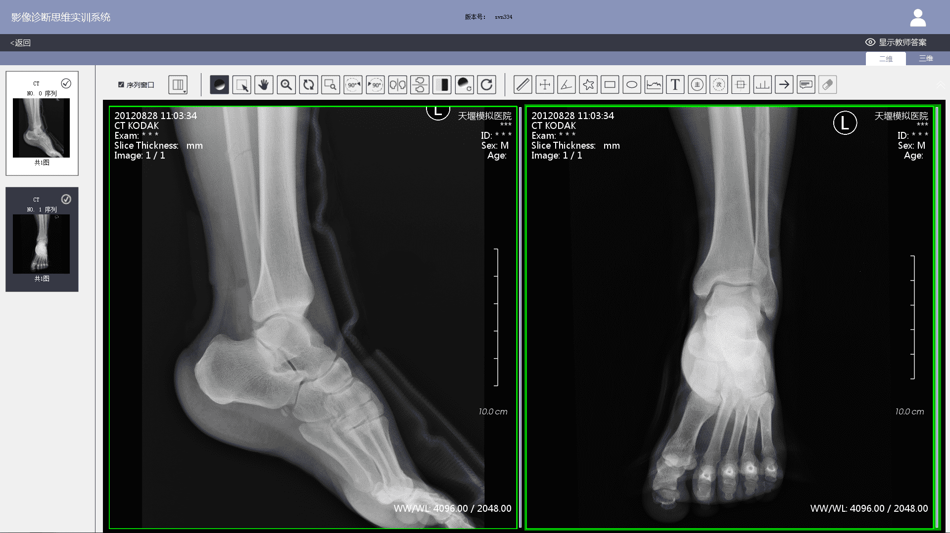 Image Diagnostic Thinking Training System