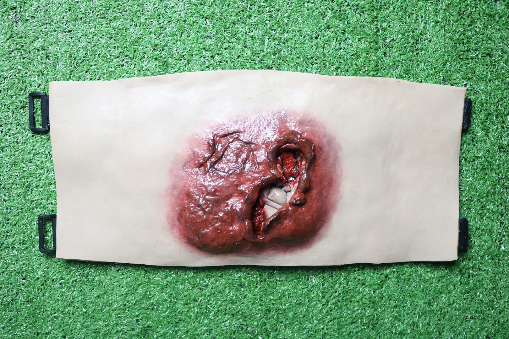 Wearable Blast Wound Kit